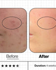 Advanced Nutrition Programme Skin Clear Biome