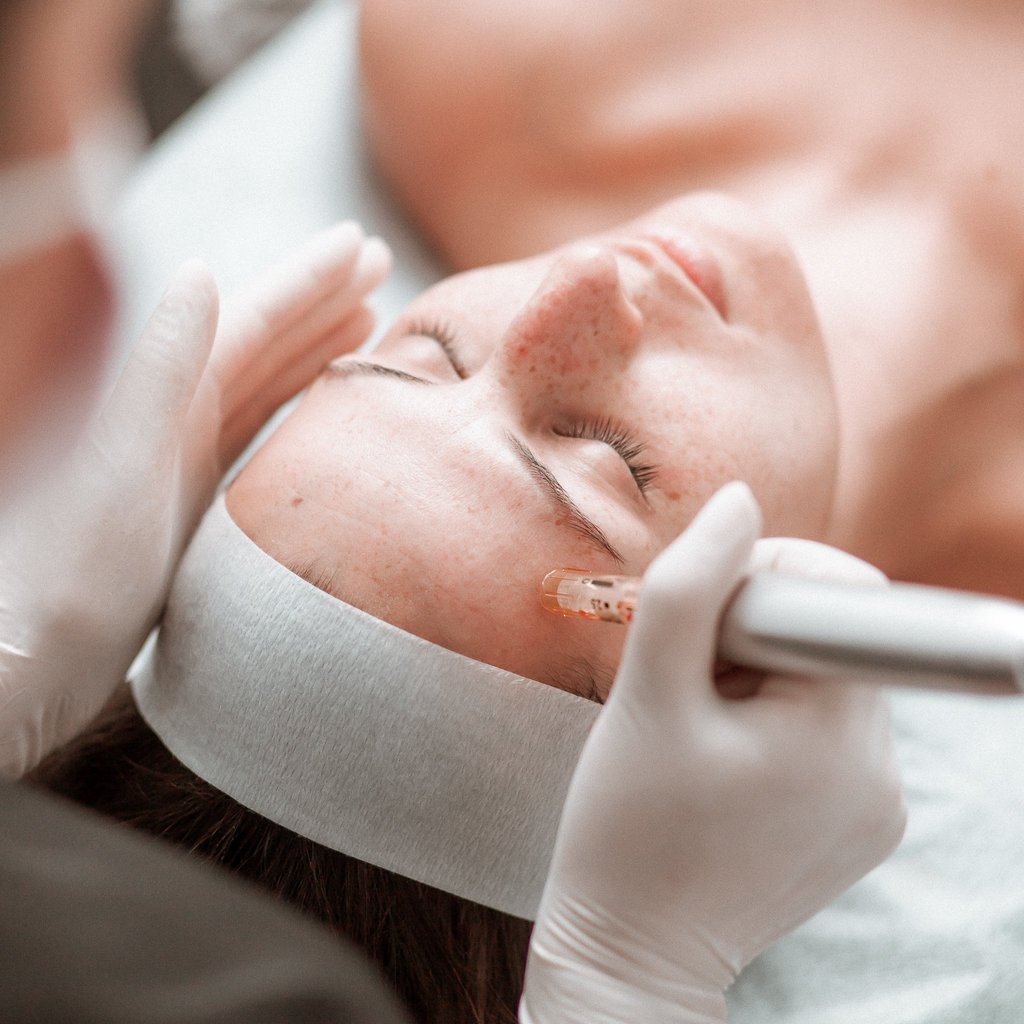 Lets talk Skin Needling