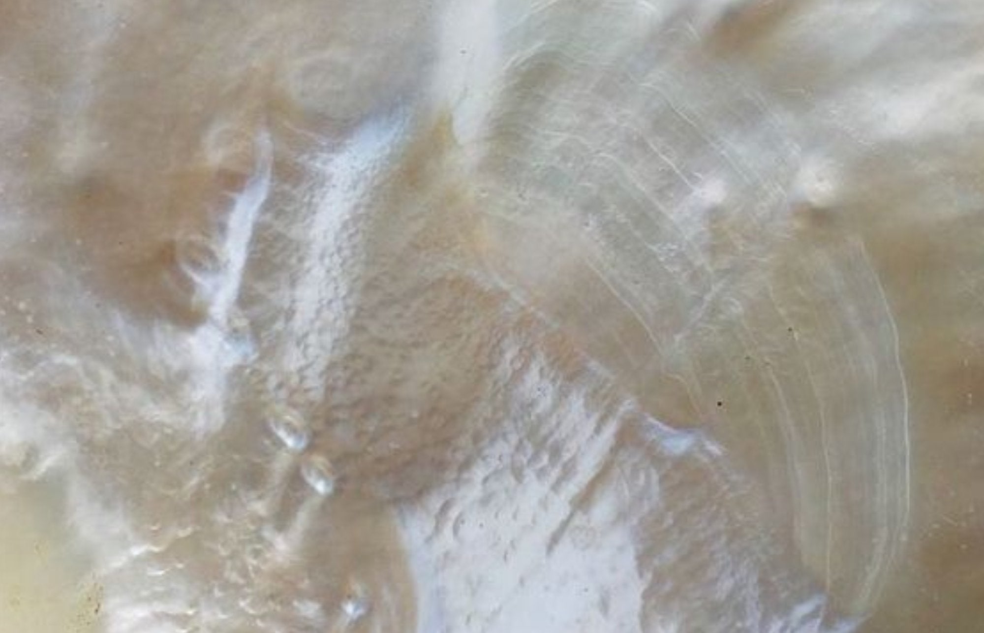 Ageing Skin
